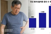 "터지기 전까지 무증상"...흡연하는 남성 노리는 '뱃속 시한폭탄'