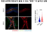 "방광염 나은 듯 하더니 또"...재발 잦은 이유 찾았다[한 장으로 보는 건강]
