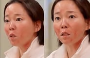 피부과 찾아갔는데 "아토피? 진료 안해" 의사 난색...SNL '미용 의사' 풍자