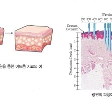 [MT리포트]LED는 어떻게 얼굴주름을 펼까