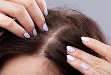 두피에도 뾰루지 난다면?…'이것' 피하세요