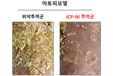 셀리버리 "자가면역질환 치료제 'iCP-NI', 미 CRO서 아토피 치료효능 입증 성공"