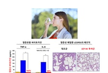 셀리버리, 주사제에 이어 흡입제 코로나 치료제 개발