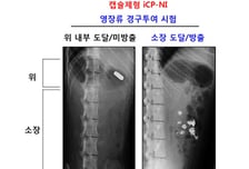 셀리버리, 코로나 치료제 영장류 캡슐제형 최적화 성공
