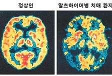 셀리버리, 치매 치료 후보물질 '신약개발 국책사업' 선정
