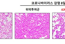 셀리버리 "iCP-NI, 코로나 치료제로 임상개발 가시화…빅파마들과 기술이전 협상"