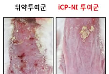 셀리버리 "iCP-NI, 아토피치료제로 글로벌 동물의약품 제약사에 기술이전 위한 데이터패키지 송부"