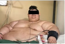 셀리버리 "고도비만 치료 신약, 식욕억제·체중감소 효능 확보"