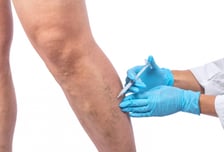 울퉁불퉁 혈관 튀어나오면 다 정맥류? 사실은…