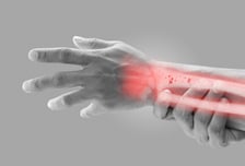 '구멍 송송' 약해진 뼈, 재채기에도 '뚝'…피검사로 치료 전략 세워야