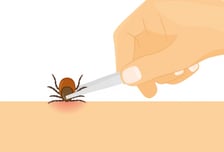 사람 몸 침투 100일 만에 500마리 번식…피부과학회, '옴' 퇴치 나선다