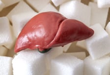 술 안 마셔도 흔한 '지방간'…2030 방치했다간 암 발병 위험↑