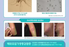 리슈만편모충증, 2년만에 국내 유입… 해외여행시 '모래파리' 주의