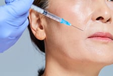 언제 이렇게 주름이 늘었지?…보톡스 시술 3가지 체크포인트