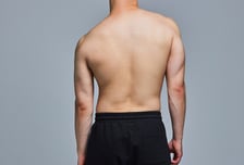 "어깨 높이 다르네" 우리 아이도 혹시?…S자 상체에 괴로운 10대들