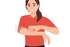 시도 때도 없이 간질간질…건선 심해지더니 '실명 위기', 왜