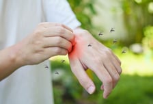 '윙윙' 소리 들리면 일반 모기…'말라리아 모기' 다른 점은?