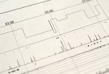 수면 생체신호 판독 AI 韓의료진이 개발…"인류 수면 질 향상 기대"