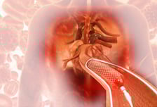 심장혈관 또 막힐라…추석연휴 부모님 '콜레스테롤 수치' 확인하세요