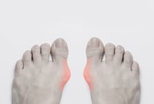 "하이힐 신고 후회"…발등이 '저릿', 방치했다간