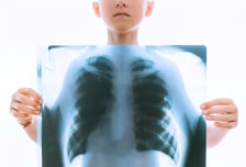 '빈곤의 질병'인데 한국이 OECD 발생률 1위…감기 증상 이 병은?