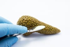 "나이 많아서" 췌장암 수술 안 받는다?…80대도 포기 말아야 하는 이유