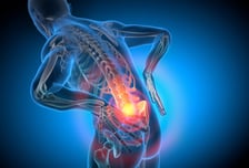 허리디스크 200만 시대…디스크 빼고 골대체재 넣는 척추유합술 뜬다