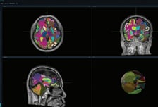 뷰노, 뇌 영상 판독하는 AI '뷰노메드 딥브레인' 기술 특허 등록