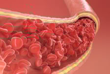 "추워도 환기해야지" 창문 열었다 가슴통증…이런 분들 조심하세요