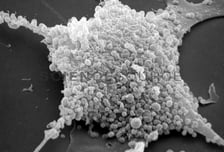 中 휩쓴 '낯선 감염병'…"한국도 환자 급증 하는 중" 대유행 경고