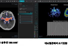 "내달부터 비급여 사용" 제이엘케이, '뇌졸중 AI 솔루션' 추가 상용화 '속도'