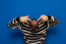 아토피 약 먹으면 머리도 풍성?…'원형탈모' 국내 임상시험 시작