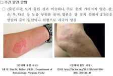 모기처럼 군데군데 원형 자국이…'빈대' 물렸을 때 대응법