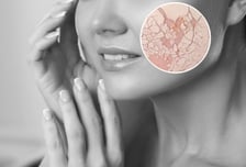 낙엽처럼 푸석푸석한 '가을 피부', 얼굴 부위별 탄력 높이는 꿀팁은