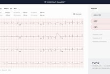 뷰노, AHA 2023서 AI 기반 심전도 연구 논문 4편 발표