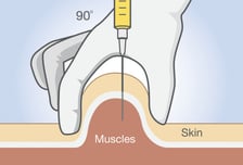주사 맞은 부위 눌러야 할까, 문질러야 할까 [한 장으로 보는 건강]