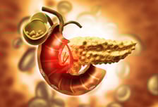 등·어깨 아파 병원 갔더니 '수술불가' 췌장암?…이런 사람들 '위험'