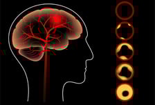 당뇨병·혈관질환 없는 한국인, 넘지 말아야 할 'LDL 마지노선' 나왔다