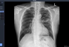 뷰노, 우즈베키스탄 군 병원 5곳에 의료 AI 솔루션 공급