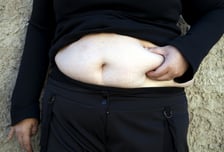 "똑같이 먹는데 왜 찔까?" 40대女 고민…"문제는 이것" 한의사 조언