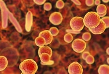 "폐렴 관련주" 개미 몰리며 주가 뛴 바이오…실상은 만년 적자