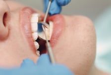 수면 내시경은 되는데 수면 임플란트는 안 된다?