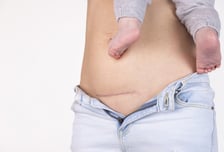 "산통 다 겪고 응급 제왕절개 최악"…20대 절반은 자연분만 안했다