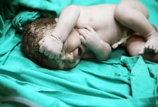 평생 건강 좌우하는데…제왕 VS 자분, 제대로 물어볼 곳이 없다