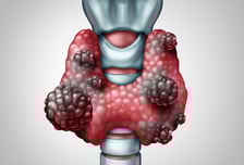 "걸리면 3개월 내 사망"…악질로 불린 '이 암' 새 치료법 찾았다