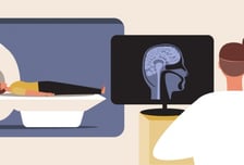 머리 부딪혔을 때 CT와 MRI 중 뭐 찍어야 할까[한 장으로 보는 건강]