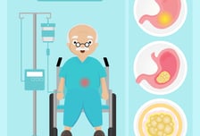 나이 많아서 '위암 수술' 포기?…생존율 영향 미치는 4가지