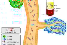 재발 예측 관건인 난소암… "혈액 속 암 조각 유전자 찾아 빠르게 진단"