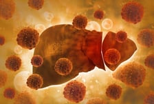 "지방간 흔한데 뭔 걱정" 넘겼는데…'침묵의 장기'가 보낸 마지막 신호