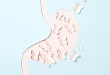 위 선종 떼도 9%는 암 발병…'이 치료' 받자 발병률 20% 낮아졌다